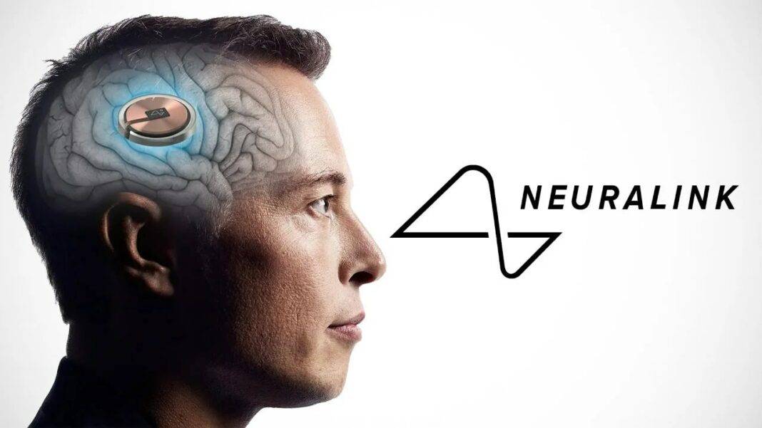 Neuralink-ը հաջողությամբ չիպ է տեղադրել մարդու ուղեղում