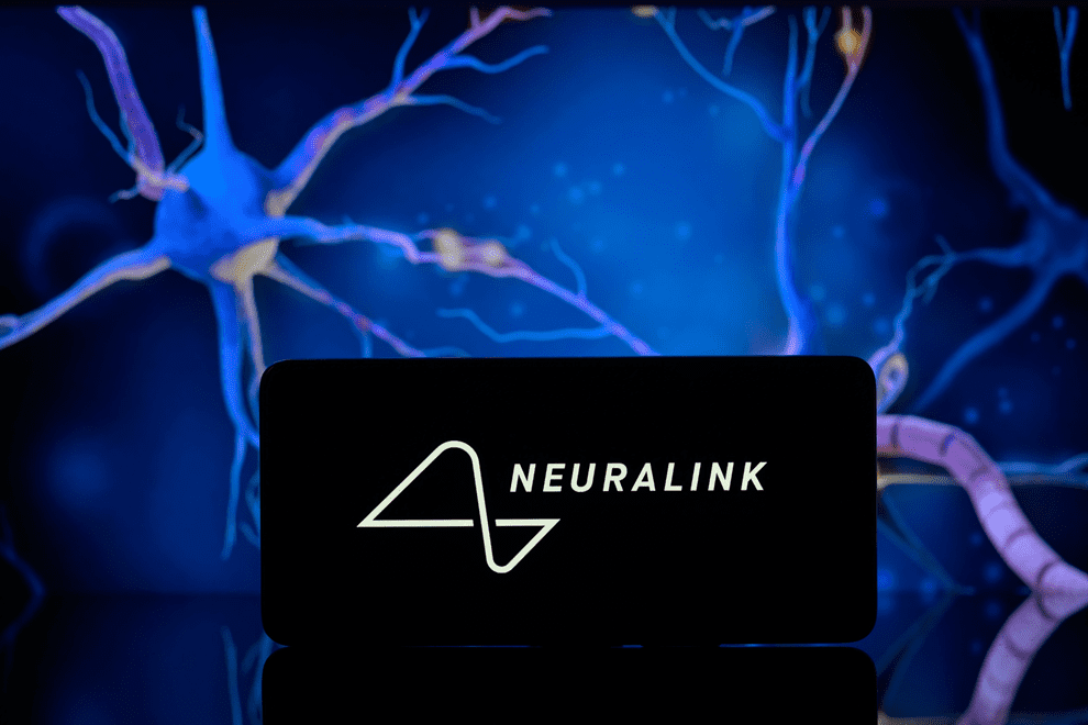 Neuralink-ը հետաձգել է ուղեղի իմպլանտի երկրորդ վիրահատությունը